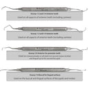 Waldent Gracey Curettes Set of 7
