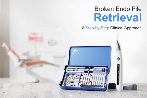 Broken Endo File Retrieval: A Step-by-Step Clinical Approach