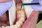 Waldent Silane Primer Syringe
