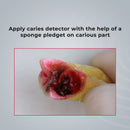 Waldent Caries Detector