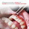 Waldent Orthobond Light Cure Orthodontic Adhesive Kit