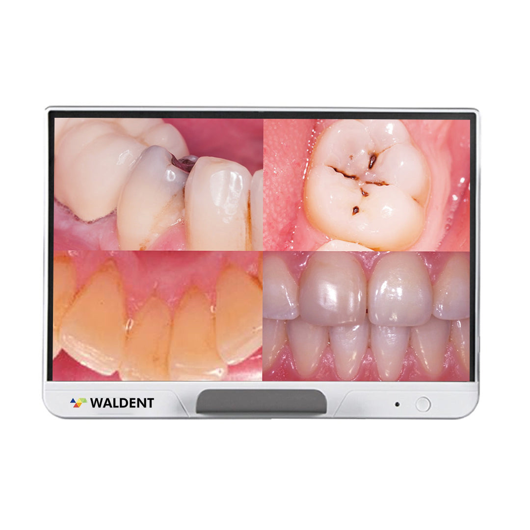 Waldent ProView Intraoral Camera System – Waldent.com