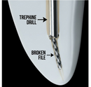 Waldent Trephine Drills For EndoResQ File Retrieval System (Pack Of 3)