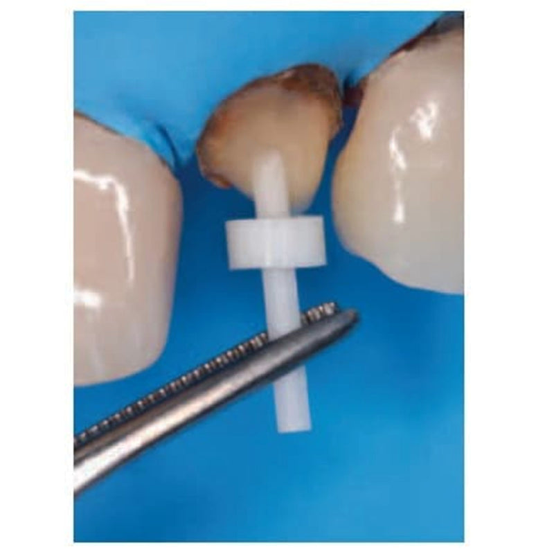 Waldent Posterior Band Remover Long TC 10/104