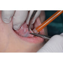 Waldent Hemostats ( Artery Forcep)