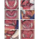 Waldent Hemostats ( Artery Forcep)