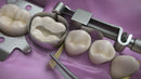 Waldent Tofflemire Retainer 8/105 - Image 4