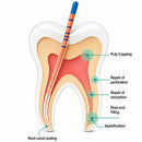 Waldent Bioactive Progressive Taper Gutta Percha Points (ProTaper Compatible) - Length Marked - Image 10