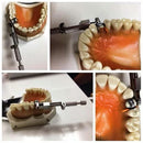 Waldent Tofflemire Retainer 8/105 - Image 7