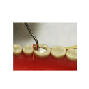 Waldent Conservative Instrument Kit of 20 (K15/1)
