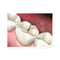 Waldent Conservative Instrument Kit of 20 (K15/1)
