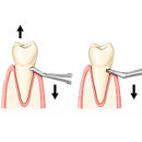 Waldent Cryer Root Elevator - Set View 4