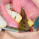 Waldent Dental Implant Guide Set (K19/15) - Image 7