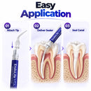 Waldent EndoLife MTA Bioceramic Root Canal Sealer - Image 4