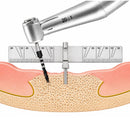 Waldent Implant Positioning Ruler (19/172) - Image 5
