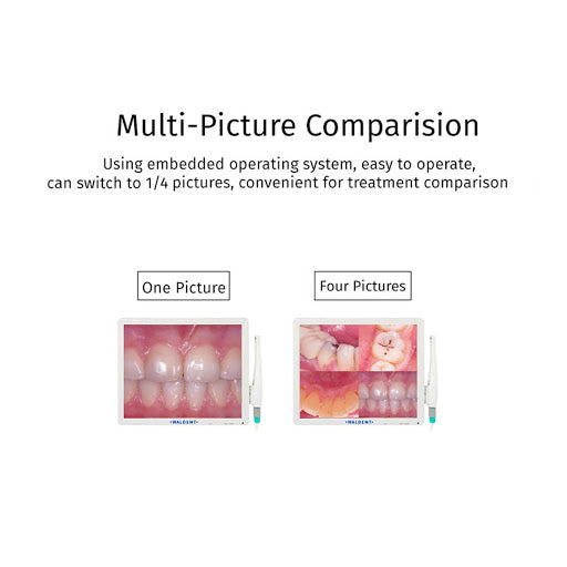 Waldent Intraoral Camera Smart - Cam with PMS