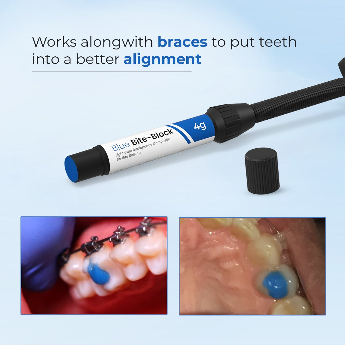 Waldent Blue BiteBlock