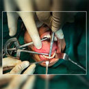 Waldent Heister Mouth Gag (8/112)