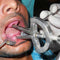 Waldent Heister Mouth Gag (8/112)