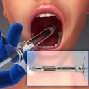 Waldent Dental Aspirating Syringe (20/101)