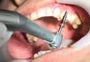 Waldent Dental Implant Handpiece 20:1 (W-772)