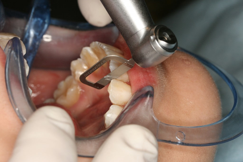 Waldent Orthodontic Inter-Proximal Reduction (IPR) Kit – Waldent.com