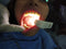 Waldent Maxbite Intraoral Lighting