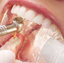 Waldent Maxbite Intraoral Lighting