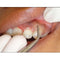 Waldent Periodontal Kit Set of 15 (K15/6)