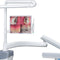 Waldent Intraoral Camera Monitor Clamp