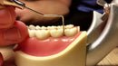 Waldent Periodontal Probes