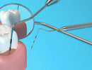 Waldent Periodontal Probes